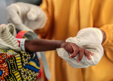 Personale medico di MSF misura la circonferenza brachiale di un bambino gravemente malnutrito, in Nigeria