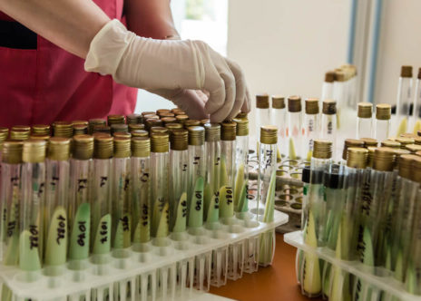 Provette con campioni di saliva per test e diagnosi di tubercolosi