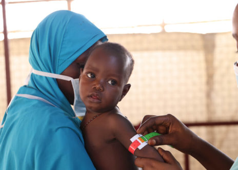 Bambino ammesso per malnutrizione in una clinica MSF a Maiduguri, Borno State